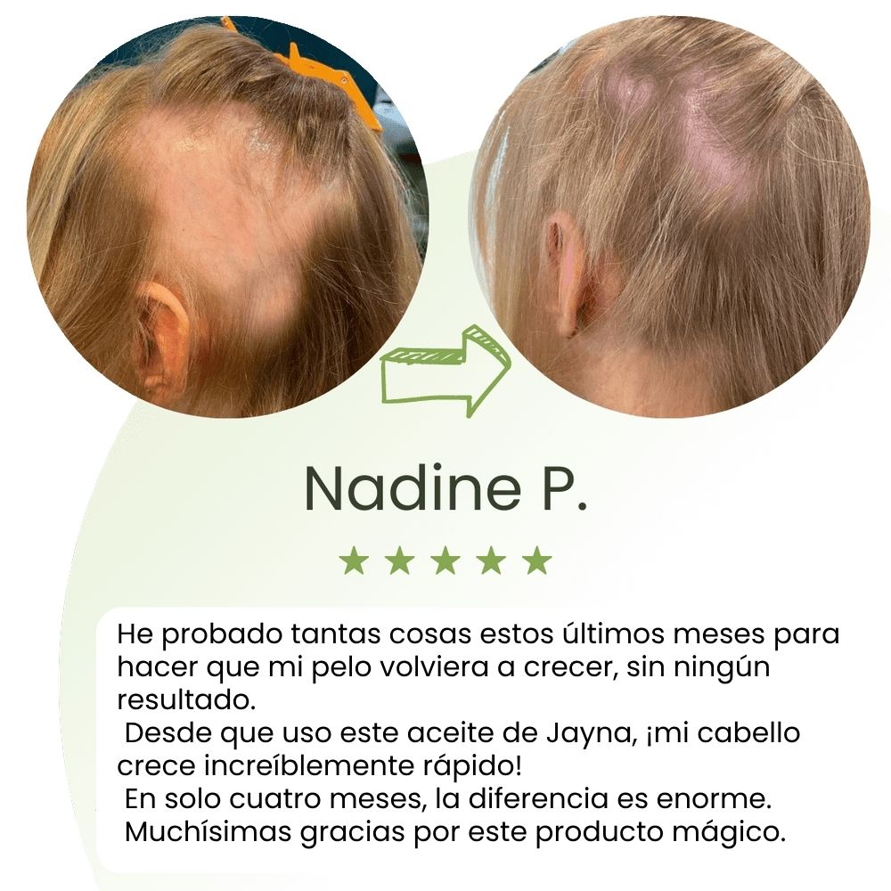 Sérum de crecimiento capilar (60 ml)