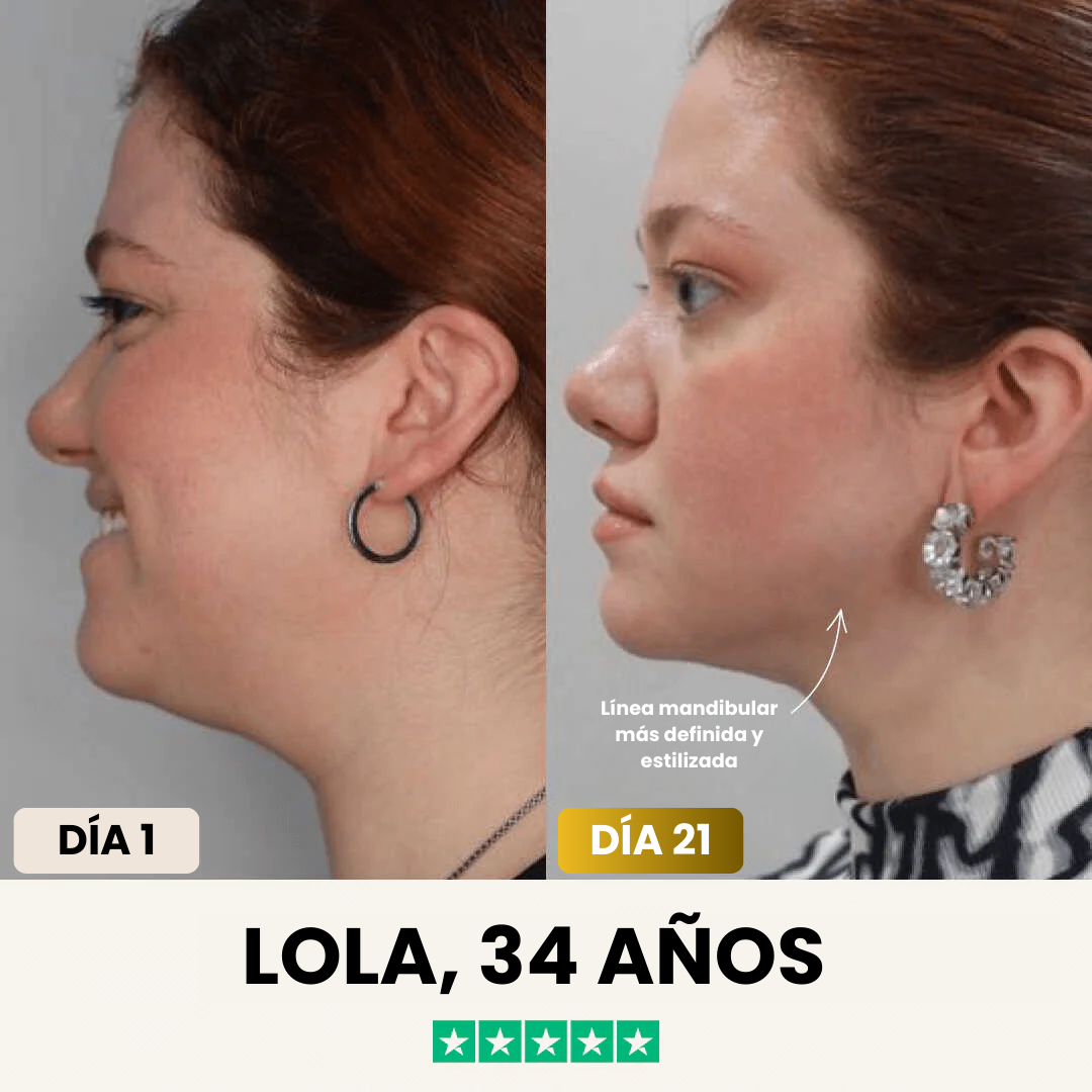 JaynaMask™ Lift - Despídete de tu papada ya