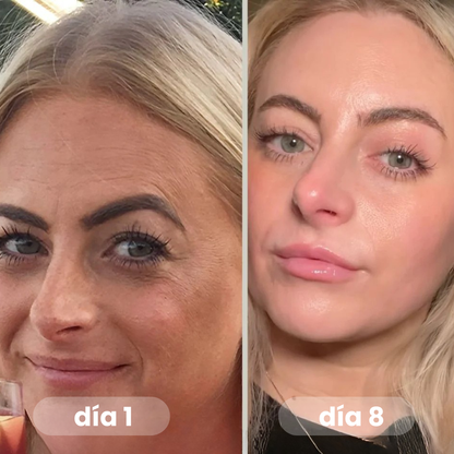 SkinMask™ – Pack x4 Mascarillas Antiarrugas y Anti-imperfecciones