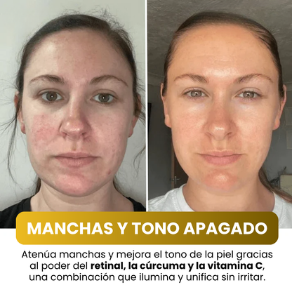 Jayna – Mascarilla Facial Coreana con Cúrcuma y Colágeno