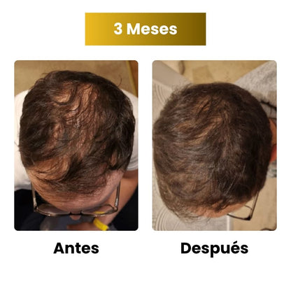 Sérum de crecimiento capilar para hombre (60 ml)