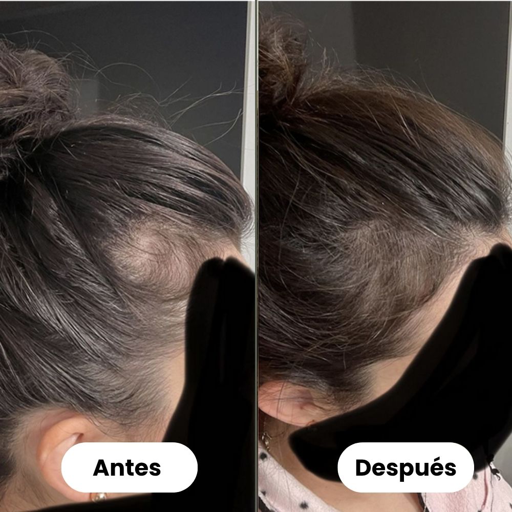 Sérum de crecimiento capilar (60 ml)