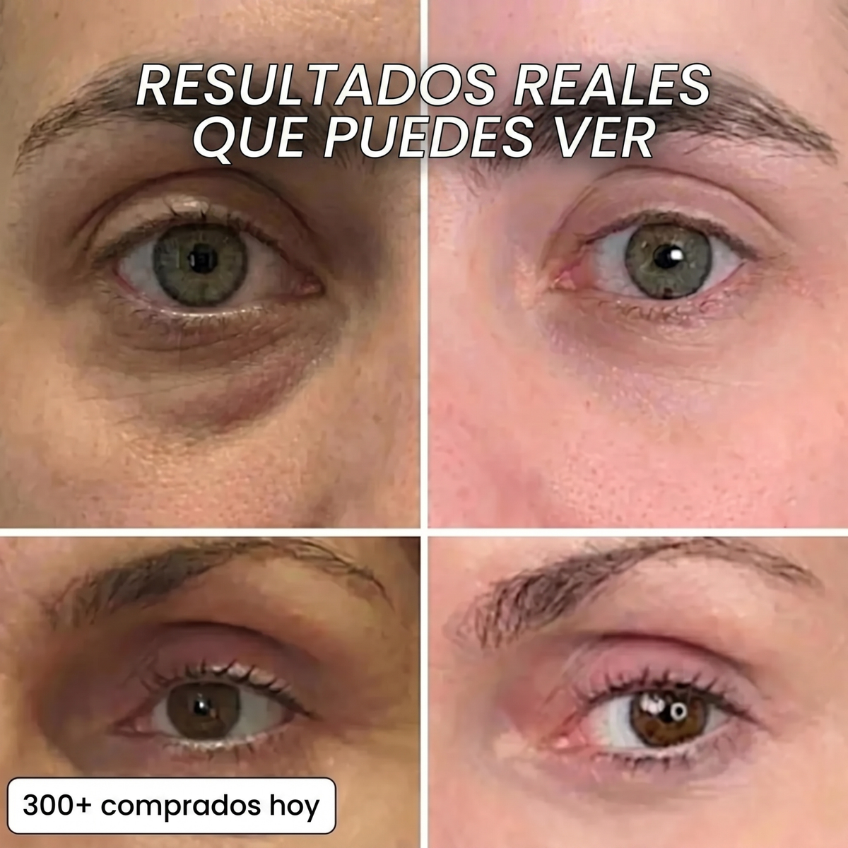 Stick Rellenador Bio-Colágeno PDRN
