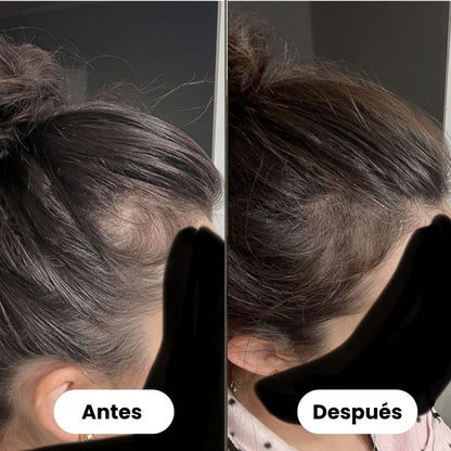 Sérum de crecimiento capilar (60 ml)