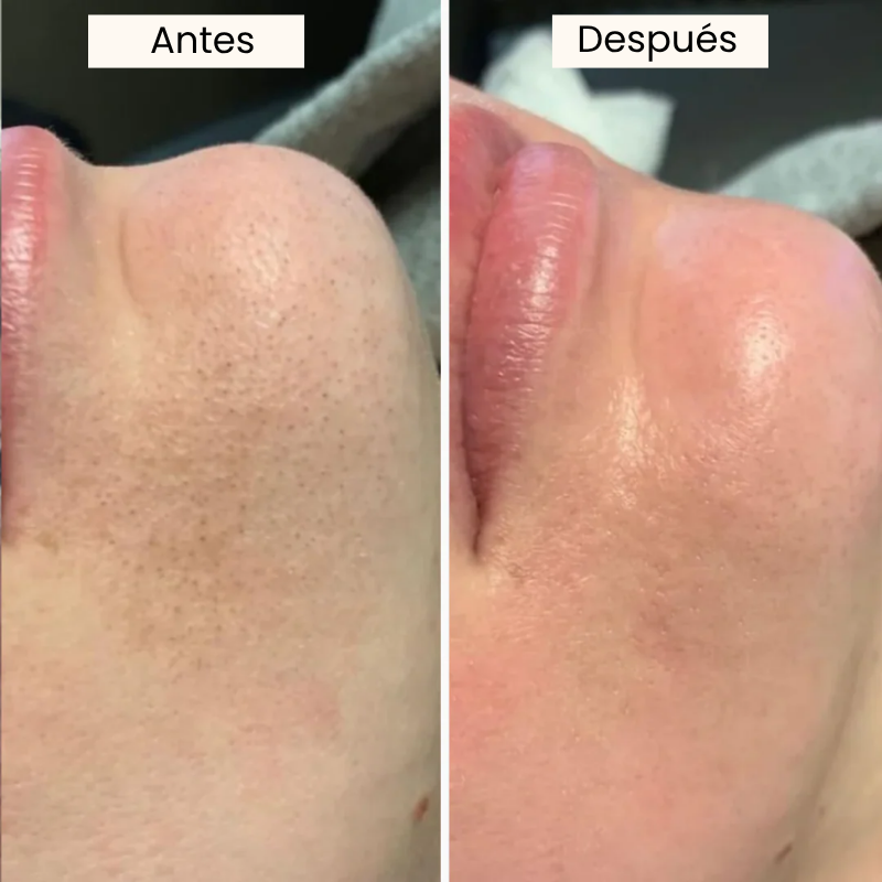 Suero Exfoliante e Iluminador Coreano de Arroz