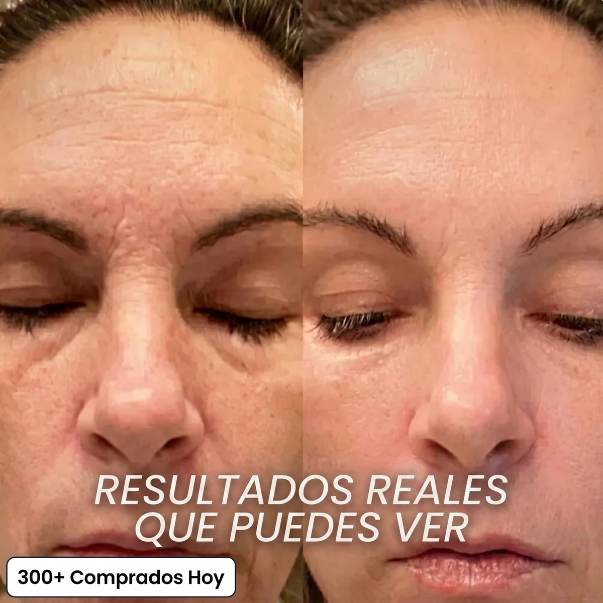 Stick Rellenador Bio-Colágeno PDRN