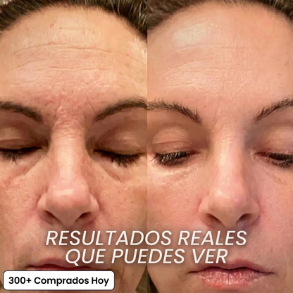 Stick Rellenador Bio-Colágeno PDRN
