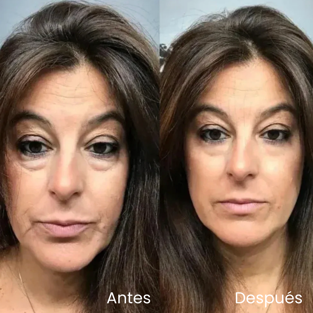 Crema contorno de ojos V-Lift