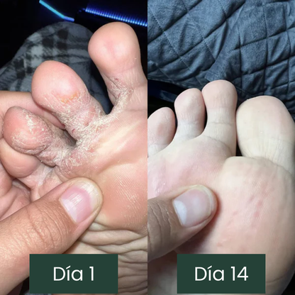 Jabón anti-hongos Jayna