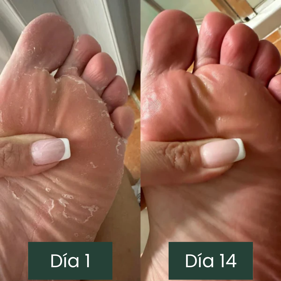 Jabón anti-hongos Jayna