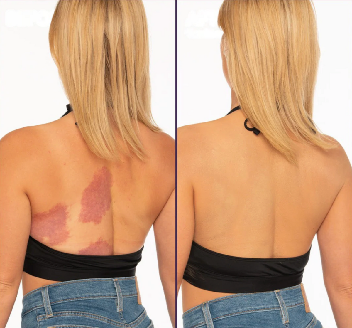 Jayna Perfector Corporal™ Maquillaje corporal de cobertura total — sin transferencia