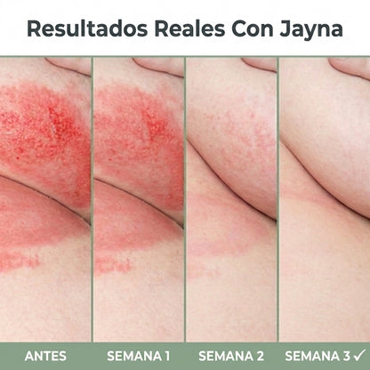 Jayna Crema Calmante para el Intertrigo
