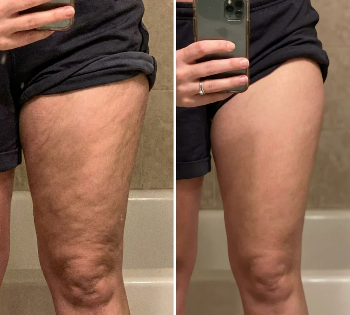 Antes y despues
