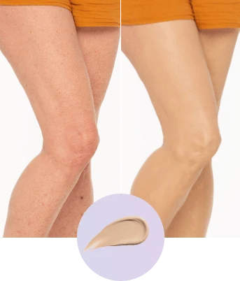 Antes y despues en las piernas
